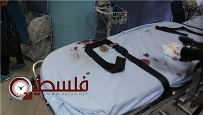 إصابة طفل بشظايا قنبلة برأسه في طولكرم